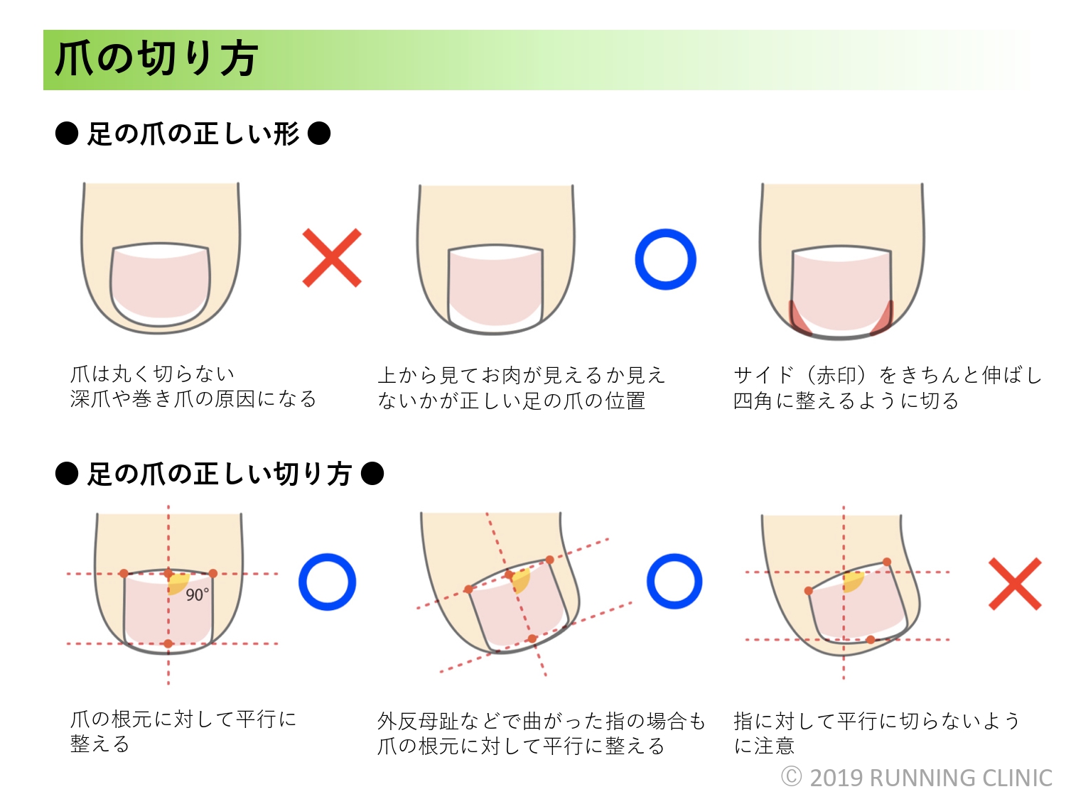 ランナーを悩ませる爪のトラブル！爪の重要な役割と手入れの仕方 RUNNING CLINIC